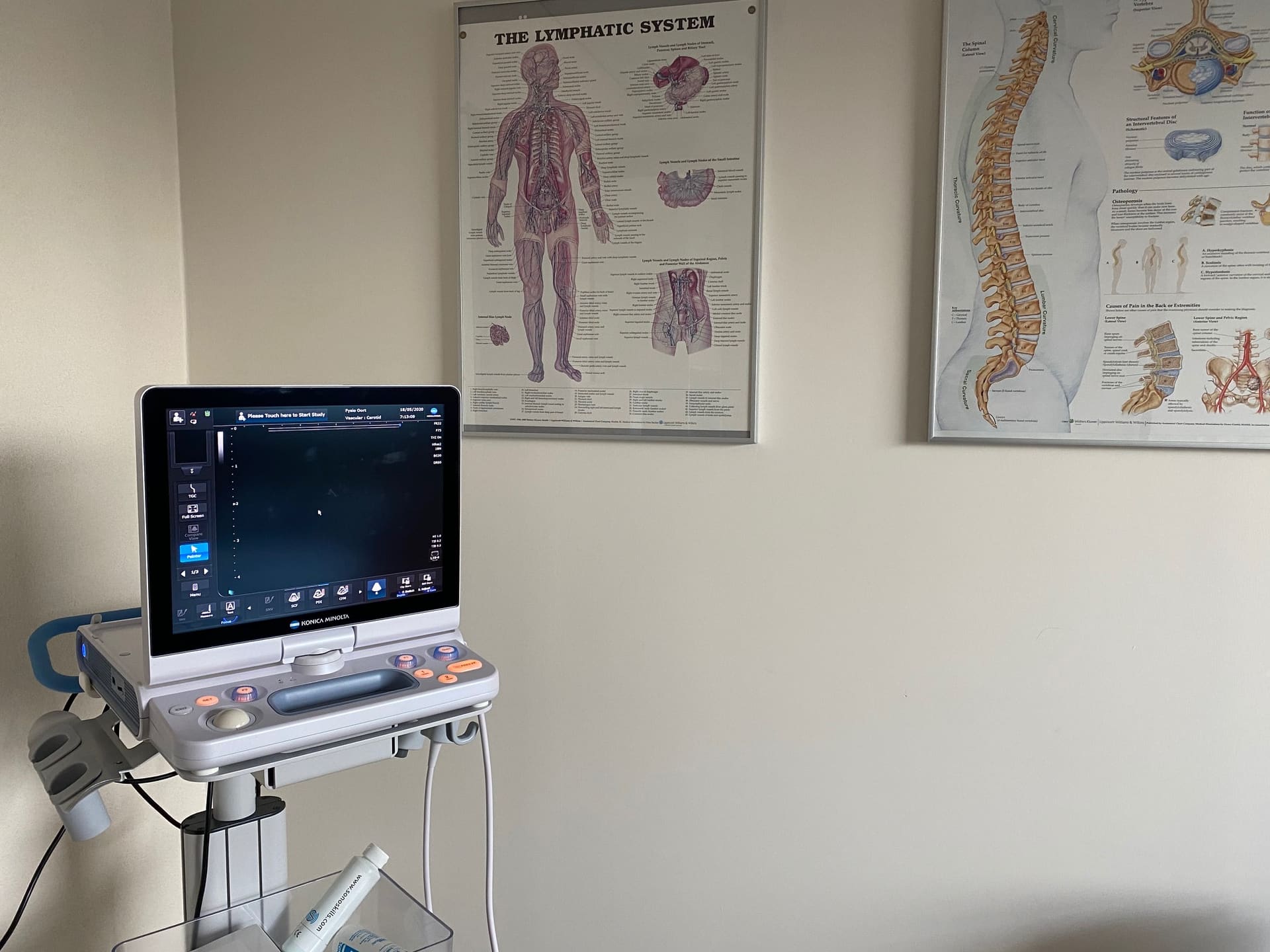 Het echografie-apparaat van Fysiotherapie Oort naast anatomische posters